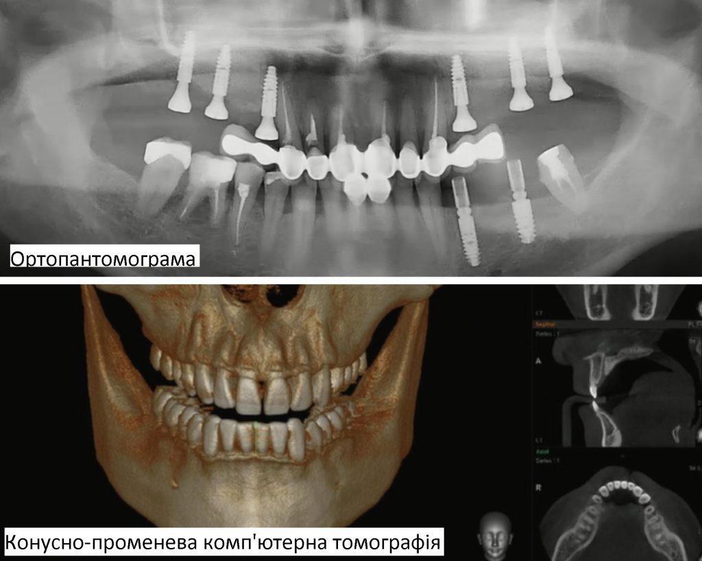 виды аппаратной диагностики зубов