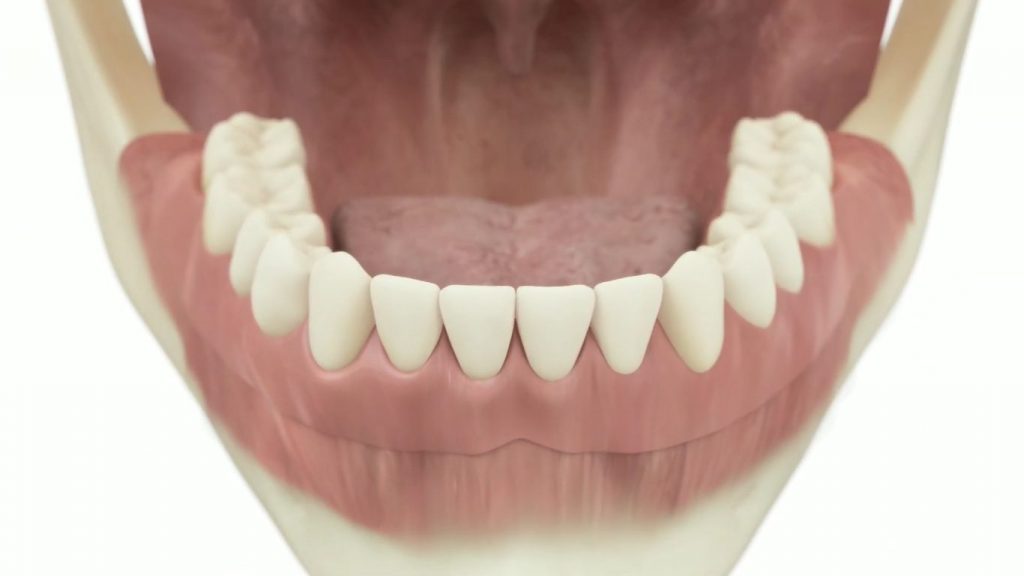 Ортопедический этап имплантации зубов