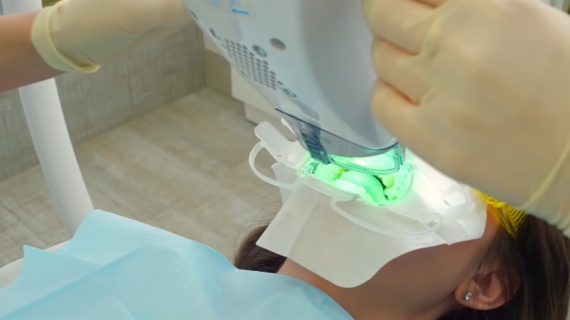 Как проходит процедура отбеливания зубов, этап 3