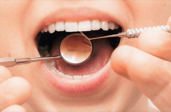 Реставрація зубів — Ціна в Дніпрі