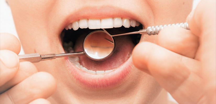 Реставрація зубів — Ціна в Дніпрі